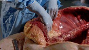 解剖吃瓜事件图片